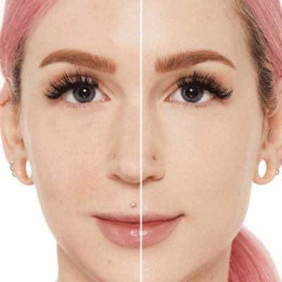 MILLANI - SCREEN QUEEN FOUNDATION