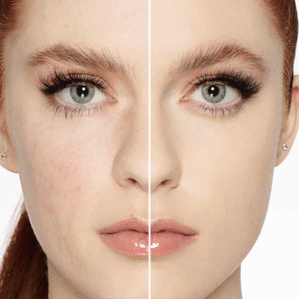 MILLANI - SCREEN QUEEN FOUNDATION